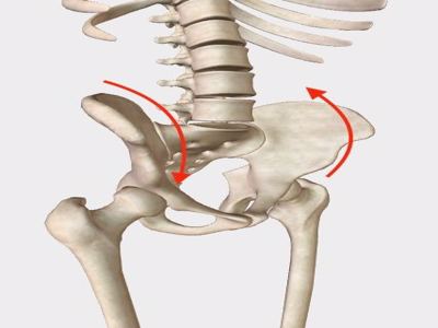 Pelvic Torsion