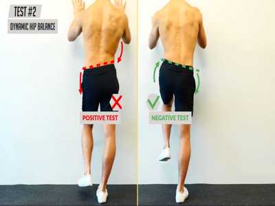 uneven pelvic