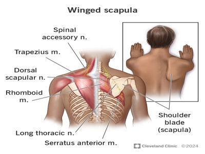 Winging Scapula Syndrome