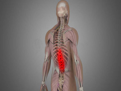 mechanical LBP